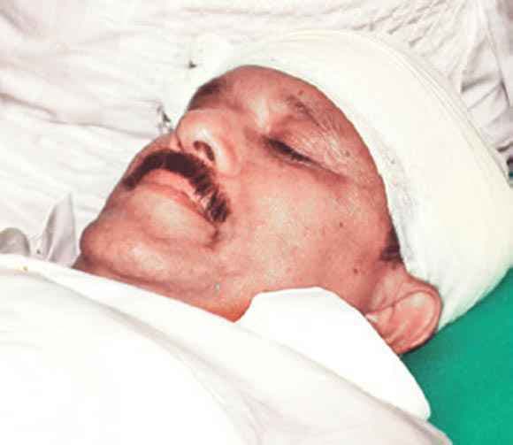 कोलकाता : ईद के मौके पर तेज आवाज में बज रहे डीजे को बंद कराने पहुंचे MLA पर पथराव