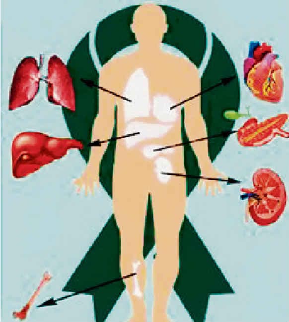 अंगदान की कमी से जूझता देश