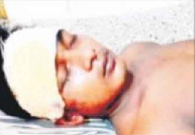 अवैध शराब ठेके का विरोध करने पर जानलेवा हमला