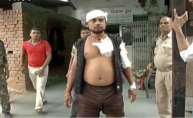 औरंगाबाद : ओवरटेक करने पर विधायक पुत्र ने मारा चाकू, MLA ने बेटे को किया पुलिस के हवाले