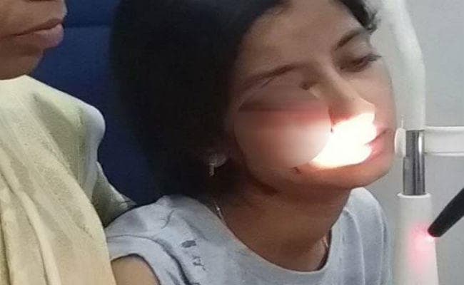 Oh No ! गर्ल्स हॉस्टल की बालकनी से आतिशबाजी देख रही लड़की की आंख में घुसा रॉकेट