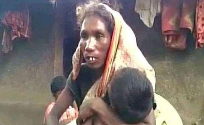 सिमडेगा मामला : बाल संरक्षण आयोग की जांच में खुलासा, मलेरिया से हुई संतोषी की मौत