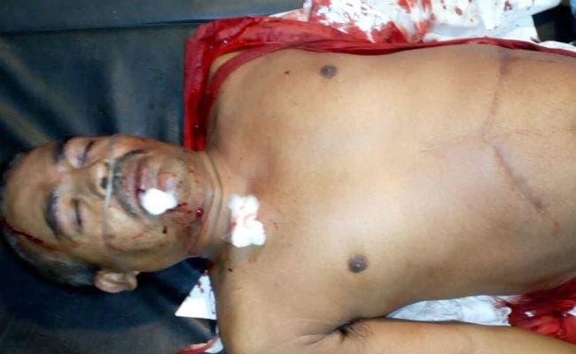 कोडरमा में कांग्रेस जिला अध्यक्ष शंकर यादव को अपराधियों ने मारी गोली, आरोपी हिरासत में