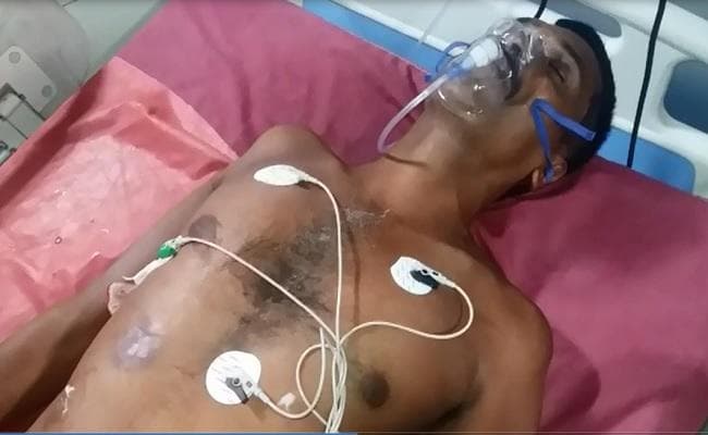 बिहार : सहरसा में जदयू नेता को मारी गाली, हालत गंभीर, VIDEO