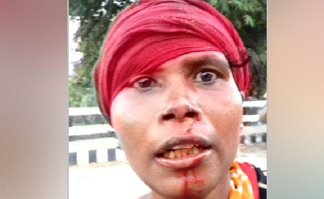 अवैध शराब के कारोबार का विरोध करने पर हमला