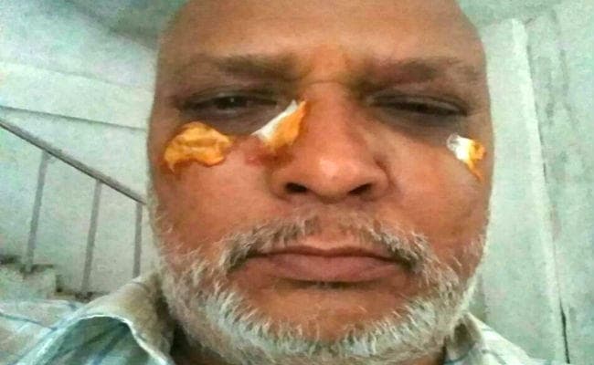 VIDEO : आपस में भिड़े भाजपा नेता, जमकर चले घूंसे, प्रदेश कार्यसमिति सदस्य को भी आयीं चोटें