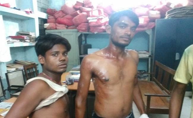 बिहार : समस्तीपुर में आपसी विवाद में गर्म तेल फेंका, तीन झुलसे