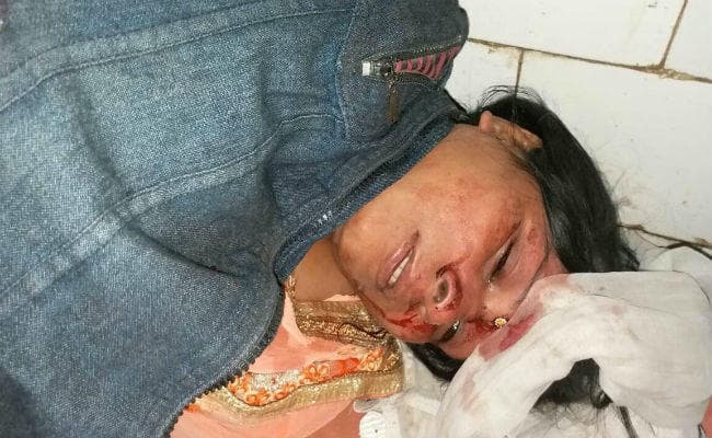 कोडरमा : बारात से वापस लौट रही बस पलटी, 30 घायल