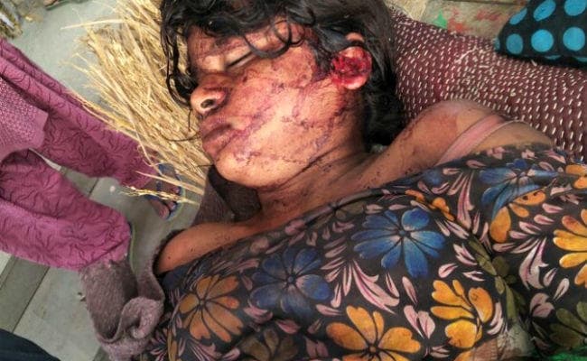 भागलपुर : झंडापुर तिहरे हत्याकांड की इकलौती गवाह बिंदी कुमारी को आया होश, बयान दर्ज कर सकती है पुलिस