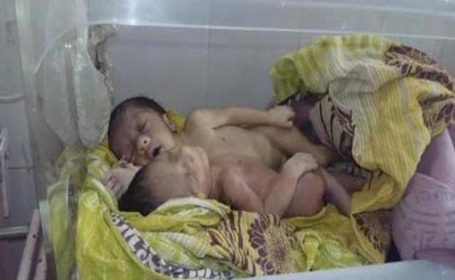 Videos : मुजफ्फरपुर में जन्मा दो सिर, चार हाथ-पैर वाला अनोखा बच्चा