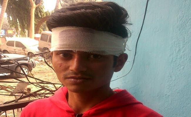 हैलमेट चेकिंग के दौरान सिपाही ने छात्र का सिर फोड़ा, हंगामा