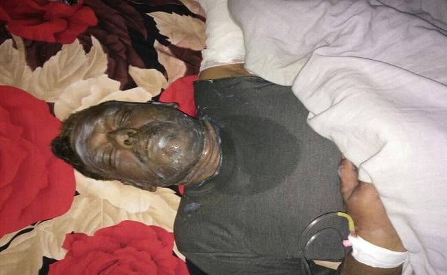 सहरसा : एसपी कार्यालय में तैनात क्लर्क सहित पत्नी आग में झुलसे, पत्नी की मौत