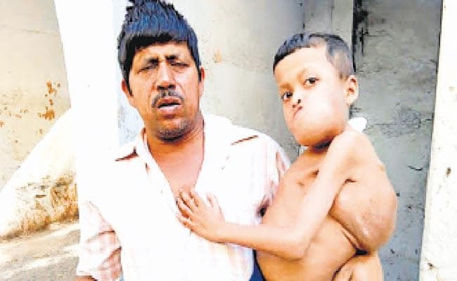 बेटे के इलाज के लिए ममता दीदी से फरियाद करेगा असहाय पिता