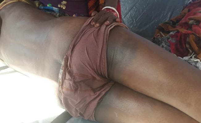 कोडरमा में पुलिस पिटाई से दलित की मौत