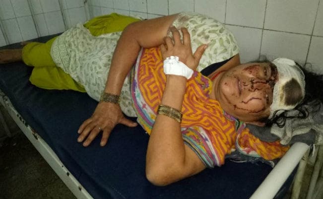 शर्मनाक : पति ने घर जमाई बनने से किया इनकार तो सास को बेरहमी से पीटा, समान भी लूट लिये, Video