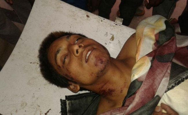 झारखंड: छात्र को रात में फोन कर बुलाया, अधमरा कर फेंका, रांची में मौत