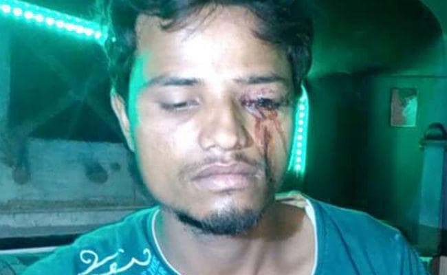 सहरसा : हॉर्न बजाया, तो ड्राइवर की फोड़ दी आंख