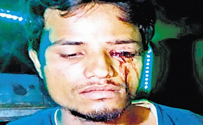 हॉर्न बजाने से गाय भड़की, तो ड्राइवर की फोड़ दी आंख