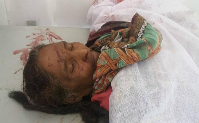 खूंटी : ऑटो पलटने से महिला की मौत