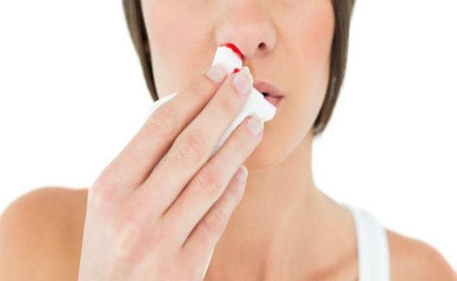 बढ़ी गरमी: नाक से आ रहा है खून, तो ऐसे करें बचाव