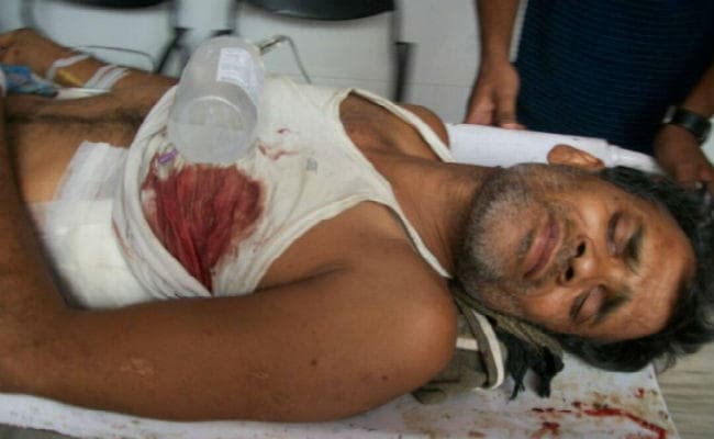 गुमला : व्यवसायी को मारी गोली, गोली पेट से आरपार