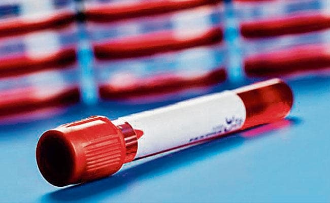 अब लैब में बनेगा कृत्रिम खून