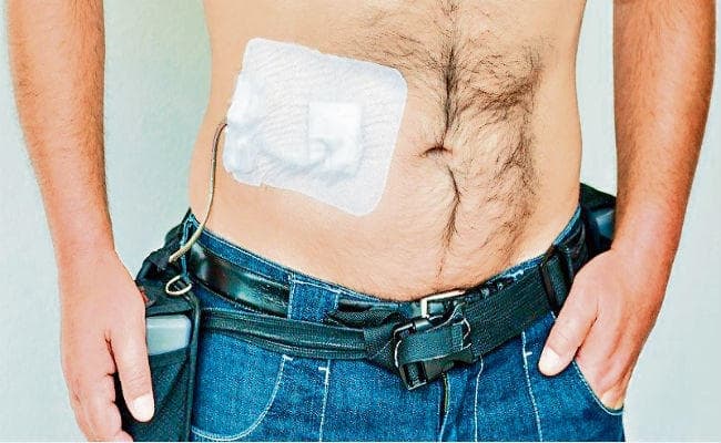 हार्ट के मरीजों की जान बचाने में सक्षम होगी वायरलेस हार्ट पंप बैटरी