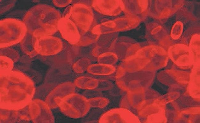 सामान्य ब्लड टेस्ट से ब्रेस्ट कैंसर का लगाया जा सकेगा अनुमान