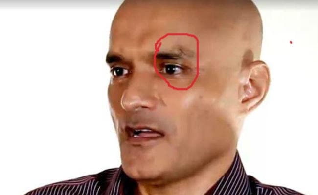 VIDEO: पाकिस्तान ने जाधव को टॉर्चर कर बनाया वीडियो, आप भी देखें चोट के निशान VIDEO: पाकिस्तान ने जाधव को टॉर्चर कर बनाया वीडियो, आप भी देखें चोट के निशान