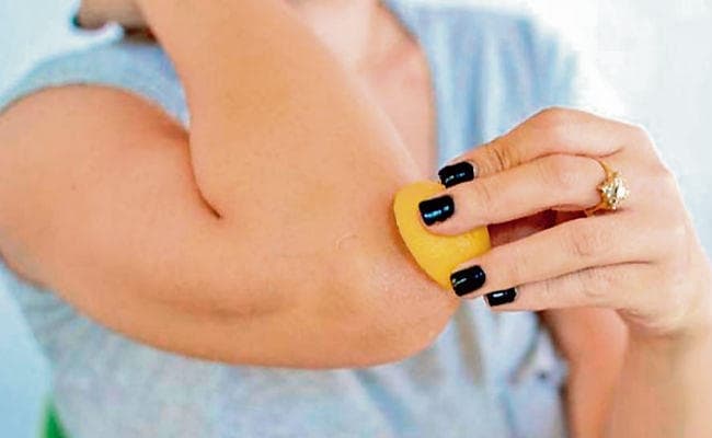 इन तरीकों से आपकी कुहनियां हो जायेंगी साफ