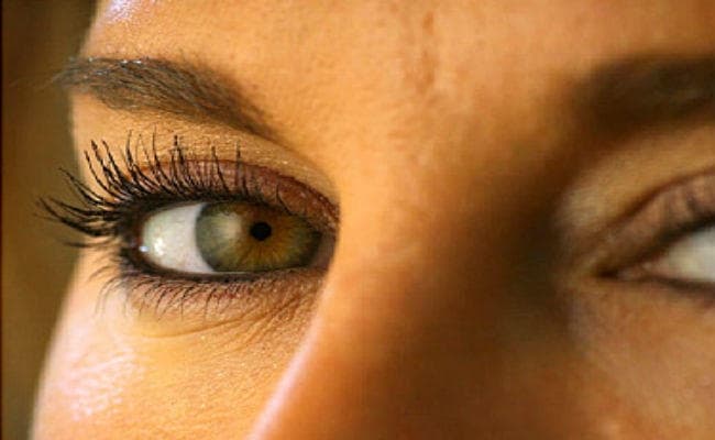 आंखों में हो खुजली तो ऐसे करें ठीक