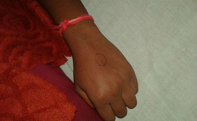 झारखंड : सर्पदंश से दो की मौत, बरसात में बढ़ती जा रही है सर्पदंश की घटनाएं