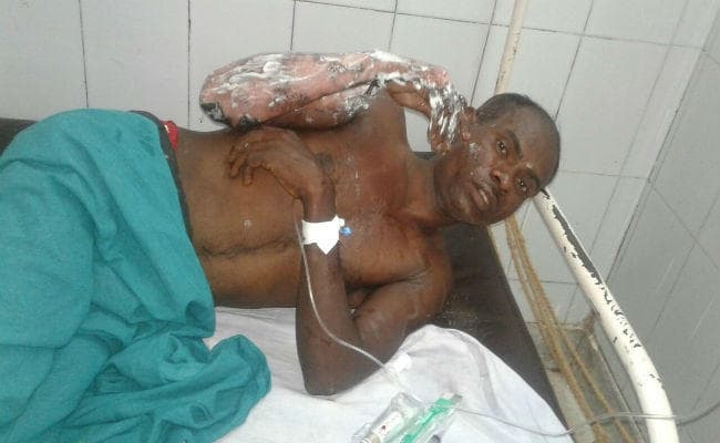 हजारीबाग : जमीन में गैस चूल्हा रख बना रही थीं खाना, विस्फोट से पति- पत्नी घायल