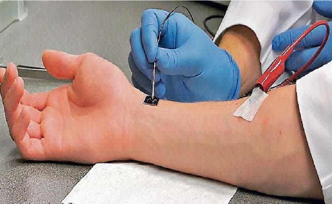 नैनोचिप के जरिये त्वचा के घावों को भरेगी इलेक्ट्रिकल डिवाइस