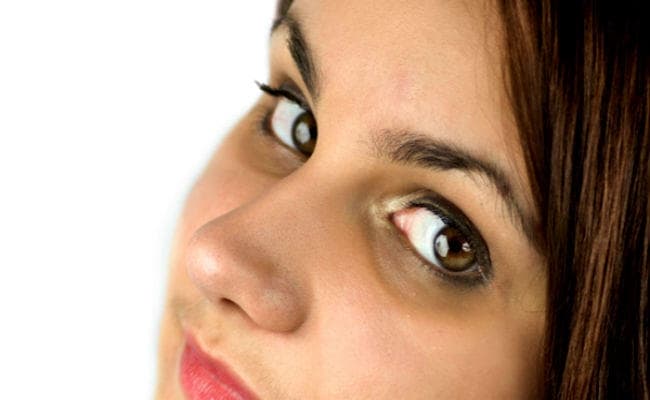 डार्क सर्कल को ऐसे दूर करे एलोवेरा से