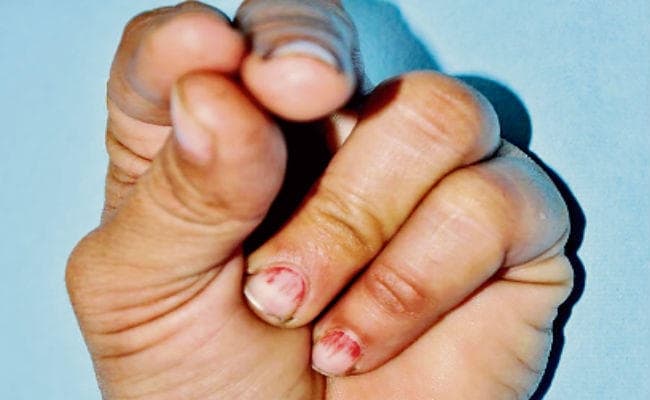 ऐसे करें कुबेर मुद्रा दूर होगा साइनस