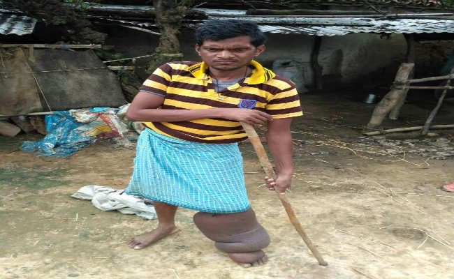 फाइलेरिया से पीड़ित लक्ष्मण कर रहा है मौत का इंतजार, नहीं मिल रही कहीं से मदद