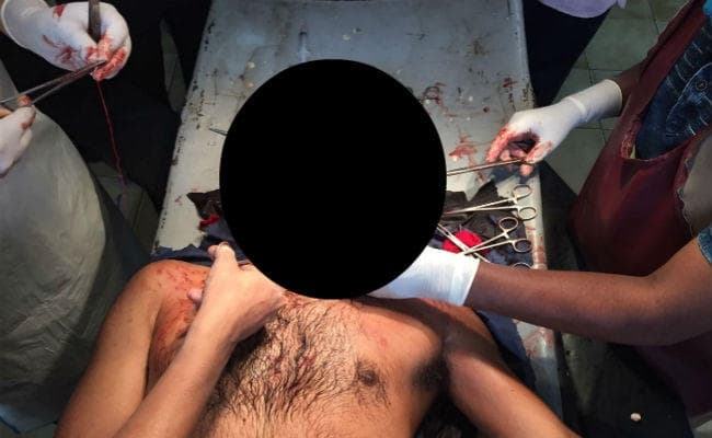 प्रेमिका के बात नहीं करने से गुस्‍साये युवक ने ब्‍लेड से काटा गला, अस्‍पताल में भर्ती