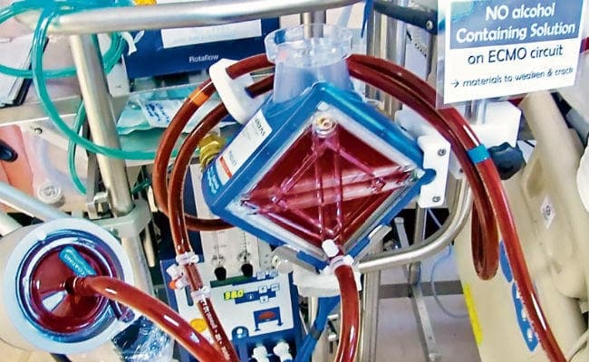 स्वाइन फ्लू में ECMO से लाभ....जानें इसके बारे में