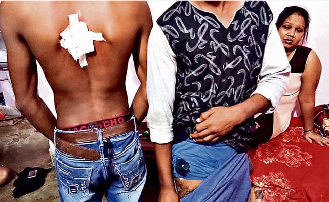 रांची : अपराधियों ने दो छात्रों को मारा चाकू, घायल