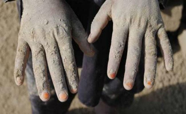 पटना : मजदूरी करते-करते फीके पड़ गये आधार को जरूरी उंगलियों के निशान, राशन बंद