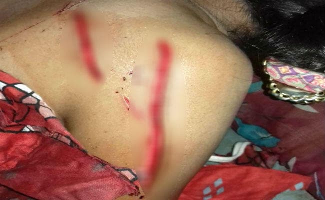 इकतरफा प्यार में आशिक ने युवती पर किया चाकू से जानलेवा हमला, इंसाफ दिलाने के लिए सोशल मीडिया पर कैंपेन चला रहे युवा