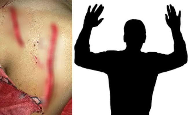 गोपालगंज : युवती को जख्मी करनेवाले सिरफिरे आशिक ने अदालत में किया सरेंडर, न्यायिक हिरासत में भेजा गया