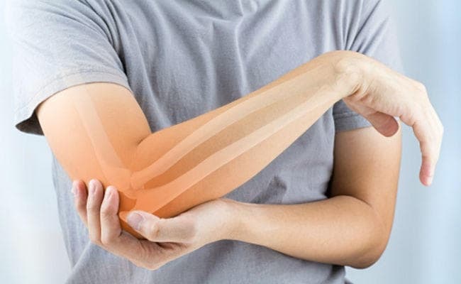 साइलेंट किलर है ऑस्टियोपोरोसिस, जानें बचाव के उपाय