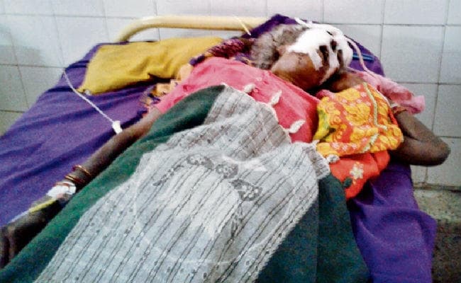 रोहतास में डायन के शक में महिला की जीभ काटी