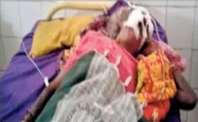 रोहतास में डायन के शक में महिला की जीभ काटी