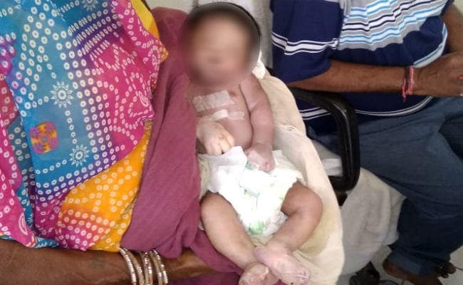 DMCH में नौ दिन के नवजात को NICU में चूहों ने काट खाया! परिजनों ने डीडीसी से की शिकायत