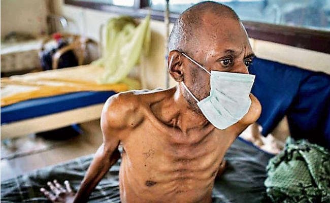 करोड़ों लोगों की जान ले सकता है एंटीबायोटिक्स, झोलाछाप डॉक्टर्स बेखौफ धड़ल्ले से कर रहे इस्तेमाल