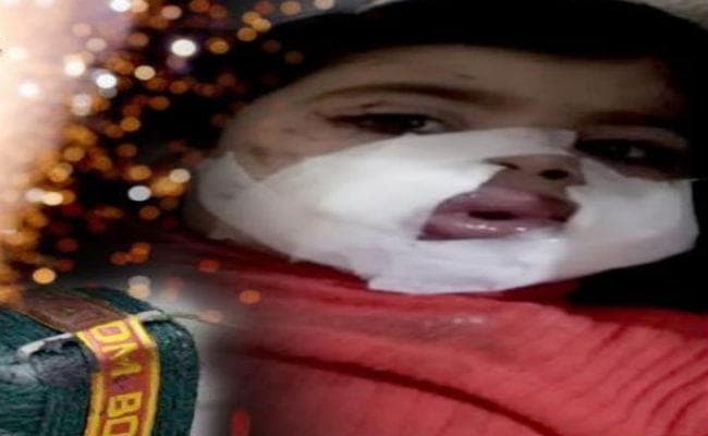 तो क्या मेरठ की 3 साल की बच्ची ने खुद ही अपने मुंह में फोड़ लिया था पटाखा?