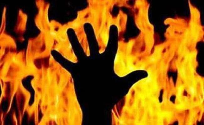छठ में पति नहीं आये घर तो, पत्नी ने लगा ली आग, गंभीर रूप से झुलसी